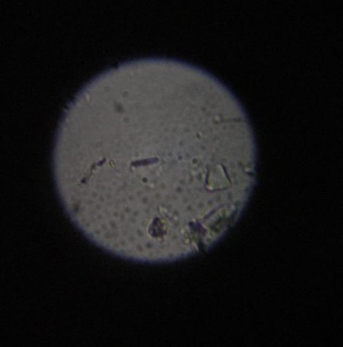 Bakterije - da ali ne - foto