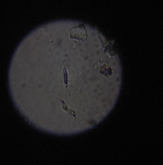 Bakterije - da ali ne - foto povečava