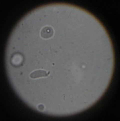 Bakterije - da ali ne - foto