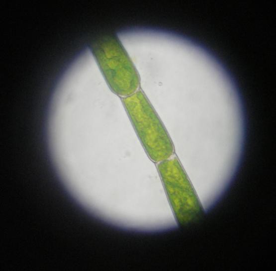 Mikrobiologija - foto povečava